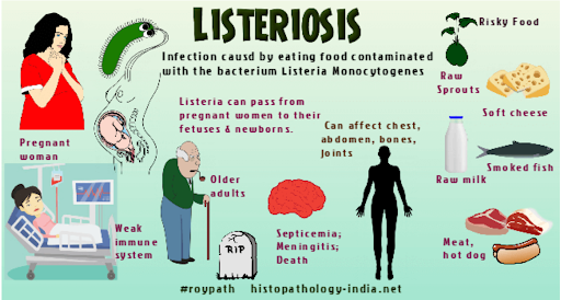 Listeriosis