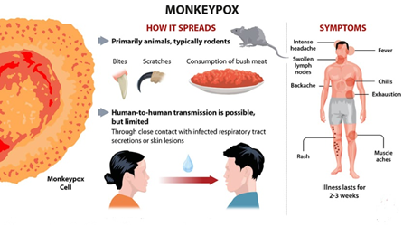 Monkeypox