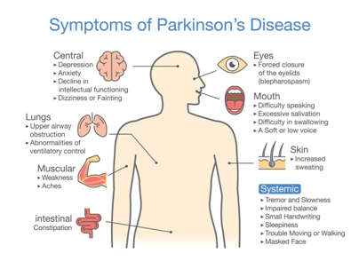 Parkinson’s Disease