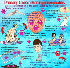 Amoebic meningoencephalitis 